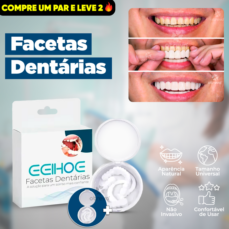Facetas Dentárias [ SUPER PROMOÇÃO]