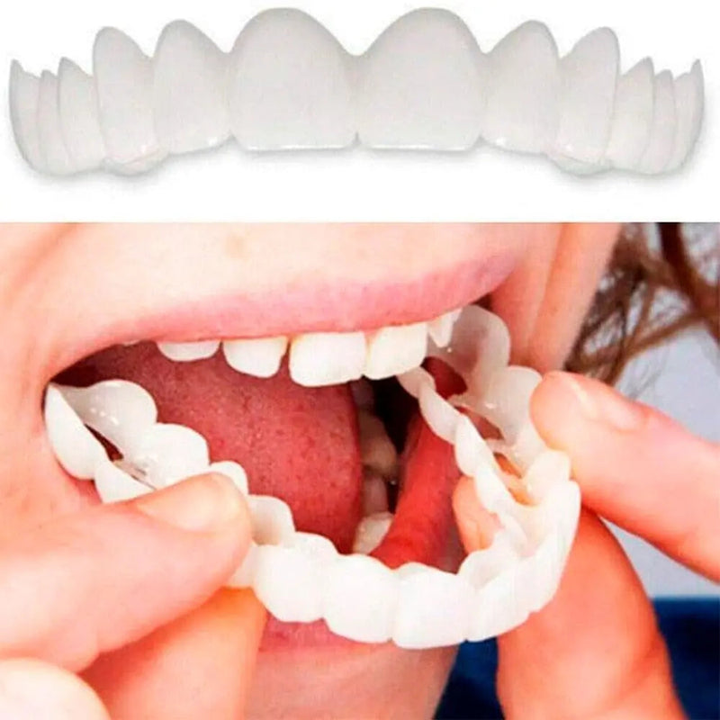 Facetas Dentárias [ SUPER PROMOÇÃO]